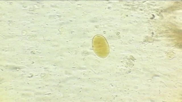 микроскопия кала #копрограмма смотреть онлайн