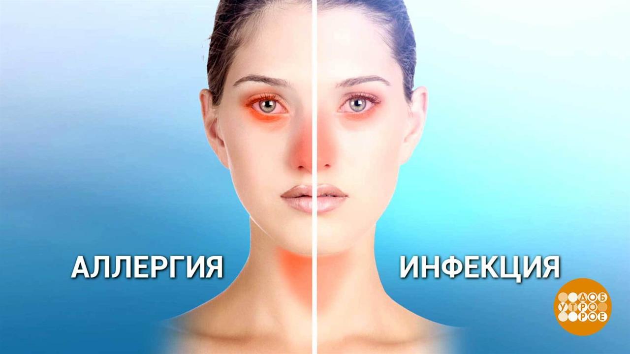Аллергия на мороз. Доброе утро. Фрагмент выпуска от 10.01.2019