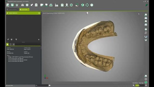 Virtual Articulator Part 2 - Scan смотреть онлайн