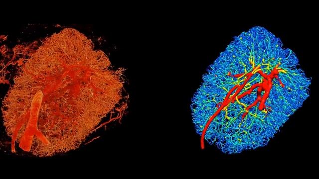 Lymph node vasculature - raw data and extracted network смотреть онлайн
