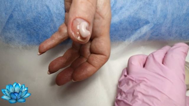 Точка вроста ногтя! Как восстановить. Ошибки в маникюре #10 смотреть онлайн