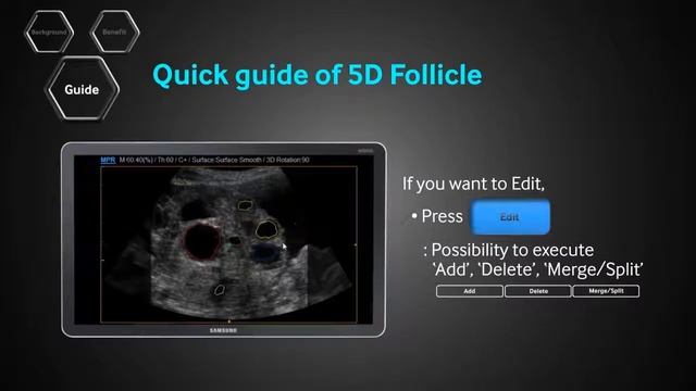 5D Follicle – пакет автоматического определения фолликулов и их размеров смотреть онлайн