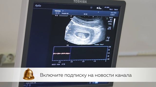 Первый Триместр Беременности: УЗИ. Скрининг ? УЗИ Плода смотреть онлайн
