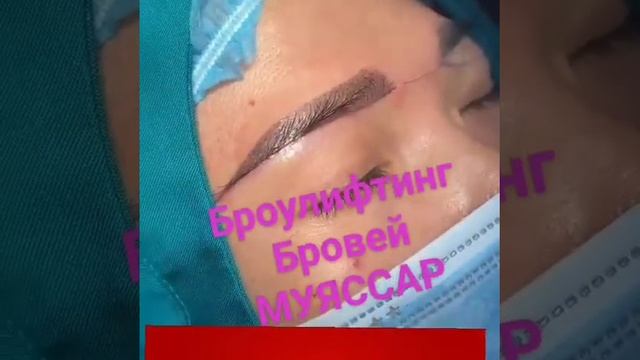 Броулифтинг Бровей Эффект приподнявщих бровей Отрытый взгляд смотреть онлайн