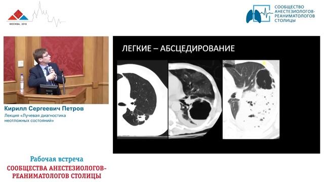 Визуализация при сепсисе Петров К.С. смотреть онлайн