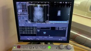 Укладка для КТ органов брюшной полости с контрастным усилением