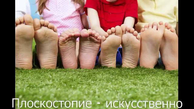 Плоскостопие - искусственно создаваемый дефект (Беседа первая) смотреть онлайн