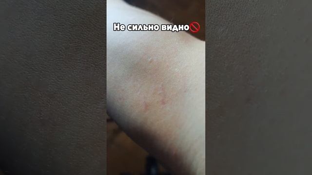 Растяжки на теле❗️Что делать❓️Ты не замечал... смотреть онлайн
