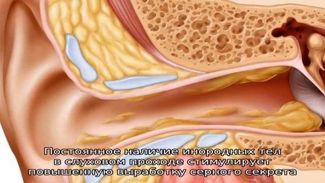 Почему в ушах образуется много серы