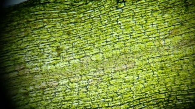 Cloroplastos de una célula vegetal al microscopio, Elodea densa смотреть онлайн