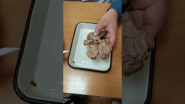 Средний мозг влажные препараты!! смотреть онлайн
