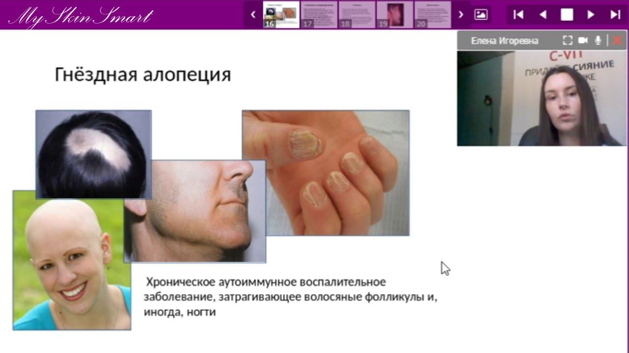 Лекция 14. Заболевания волос смотреть онлайн