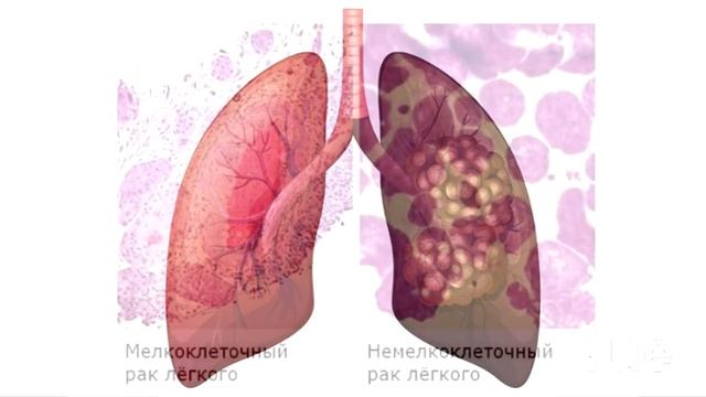 Пропал аппетит // Ничего не лезет в горло // Что со мной??? смотреть онлайн