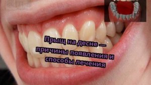Прыщ на десне — причины появления и способы лечения