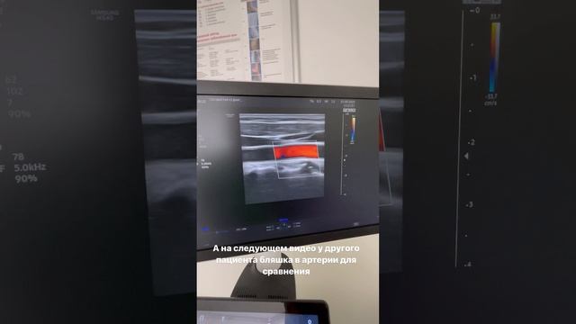 Обследование сосудов. Узи сосудов. Патологии сосудов не выявлено. Флеболог Москва. Флеболог смотреть онлайн