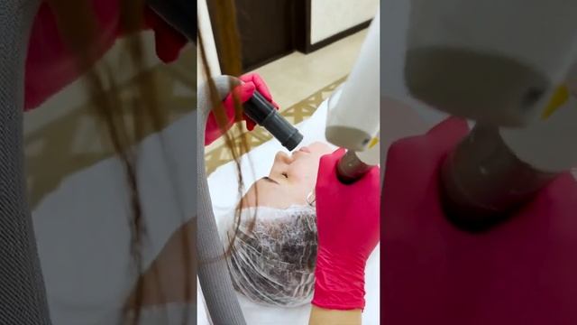 лазерная шлифовка смотреть онлайн