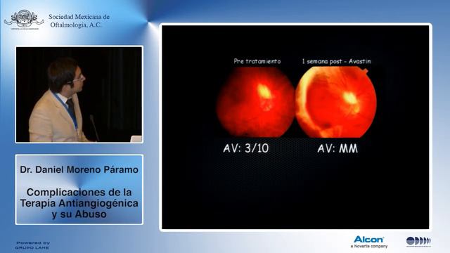 Dr. Daniel Moreno Páramo - Complicaciones de la Terapia Antiangiogénica y su Abuso 22/08/14 смотреть онлайн