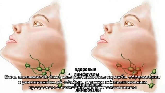 Воспалился лимфоузел за ухом смотреть онлайн