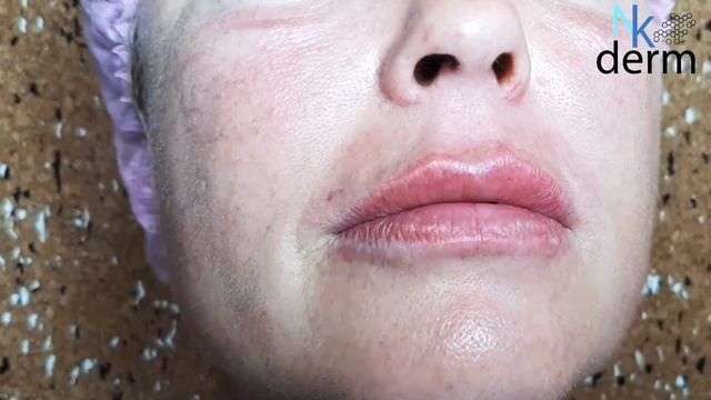 Губы "Natural lips " смотреть онлайн