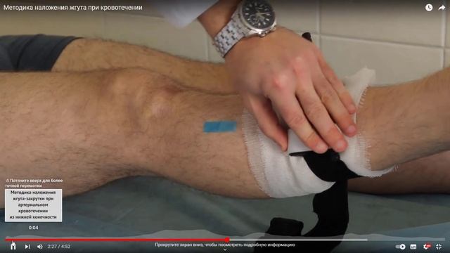 Правила наложение жгута-турникета при артериальном и венозном кровотечении смотреть онлайн