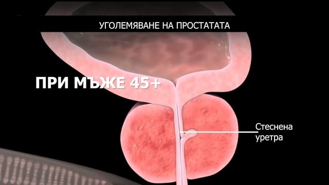 Простамакс / Prostamax