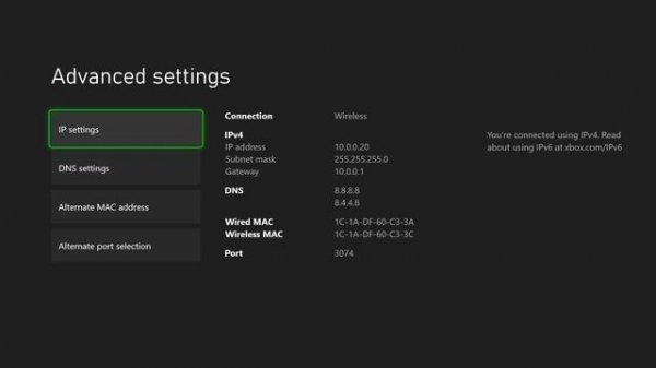 How To Fix Xbox Series X / Xbox One Error Code 0x80072ee2 - (Quick Fix!)