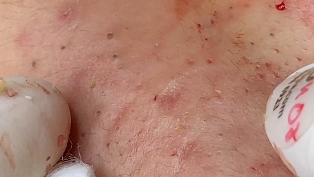 Relax Every Day With Sac Dep Spa #0407 смотреть онлайн