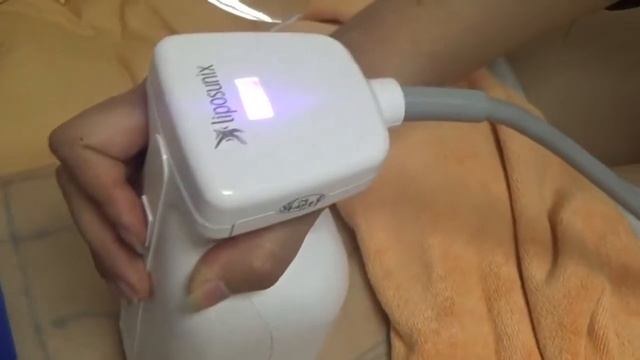 Liposonix Operation Video