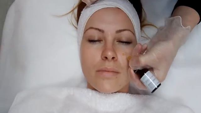 PQAge ПИЛИНГ в салон Барселонета Парк & Спа