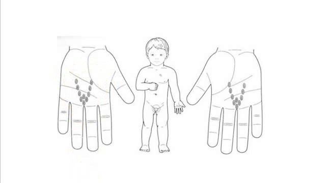 РЕБЕНОК ПИСАЕТСЯ, КАК ВЫЛЕЧИТЬ БЫСТРО И БЕЗ ТАБЛЕТОК! смотреть онлайн