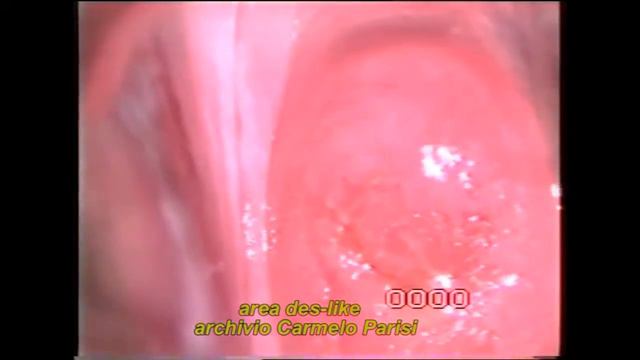 Colposcopia: area des like смотреть онлайн