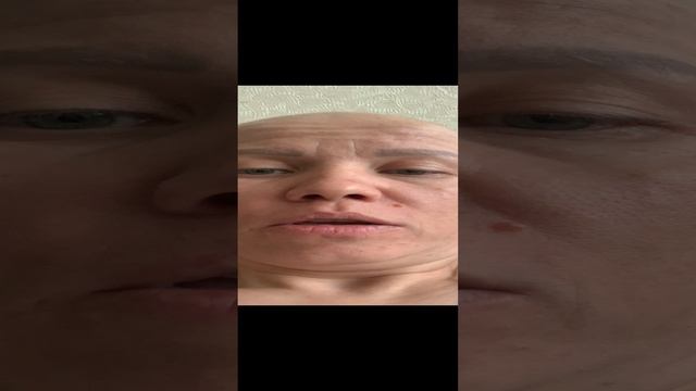 Поликлиника и прикрепление к ней смотреть онлайн