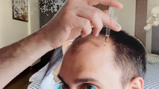 Thick Hair Challenge : शैम्पू में बस 2 बूंदे मिला के लगायें, बालों का झड़ना रोकें और Density 3X बढ़ाय