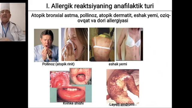 Atopik Kasalliklarga Zamonaviy Qarashlar  Tizimli Kasallik Sifatida Allergik Kasalliklar Tasnifi  S