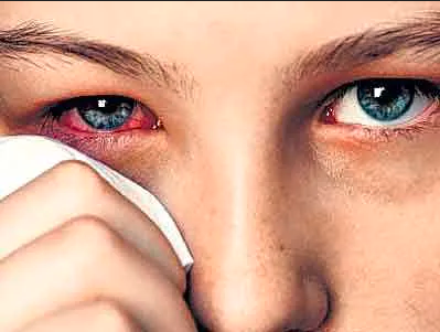 БРЕВНО И СОРИНКА