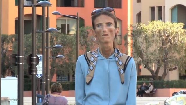 Thinnest People In The World
