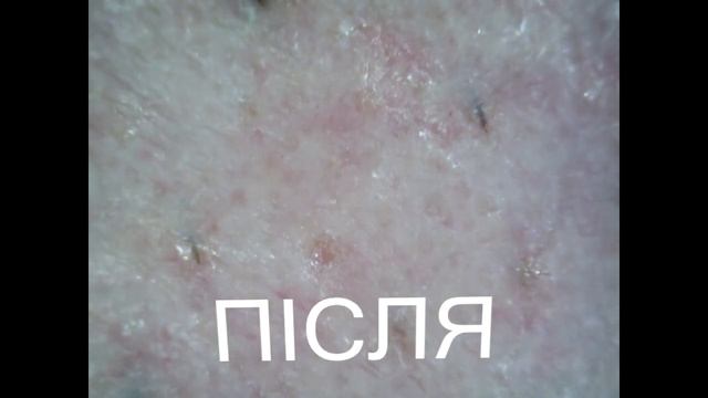 Голюся опаскою після тешки. смотреть онлайн