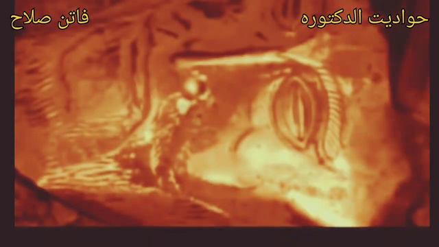 حصان طرواده و الكنز الذهبي حقيقه ام اسطوره | الجزء ٢ || حواديت الدكتوره فاتن صلاح смотреть онлайн