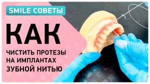 Гигиена протезов на имплантах ? можно ли пользоваться зубной нитью?