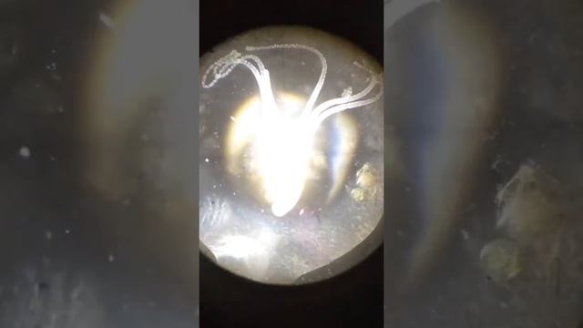 Бактерии под микроскопом 5 смотреть онлайн