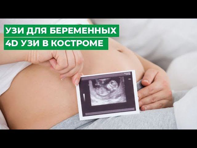 УЗИ для беременных / 4D УЗИ в Костроме / МЦ МИРТ смотреть онлайн