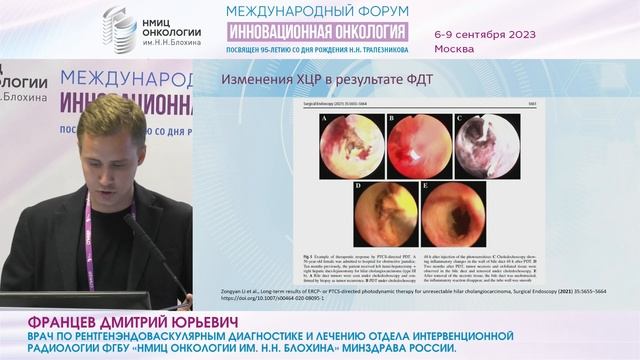 Эндобилиарные лечебные вмешательства у больных холангиокарциномой_Францев Д.Ю. смотреть онлайн