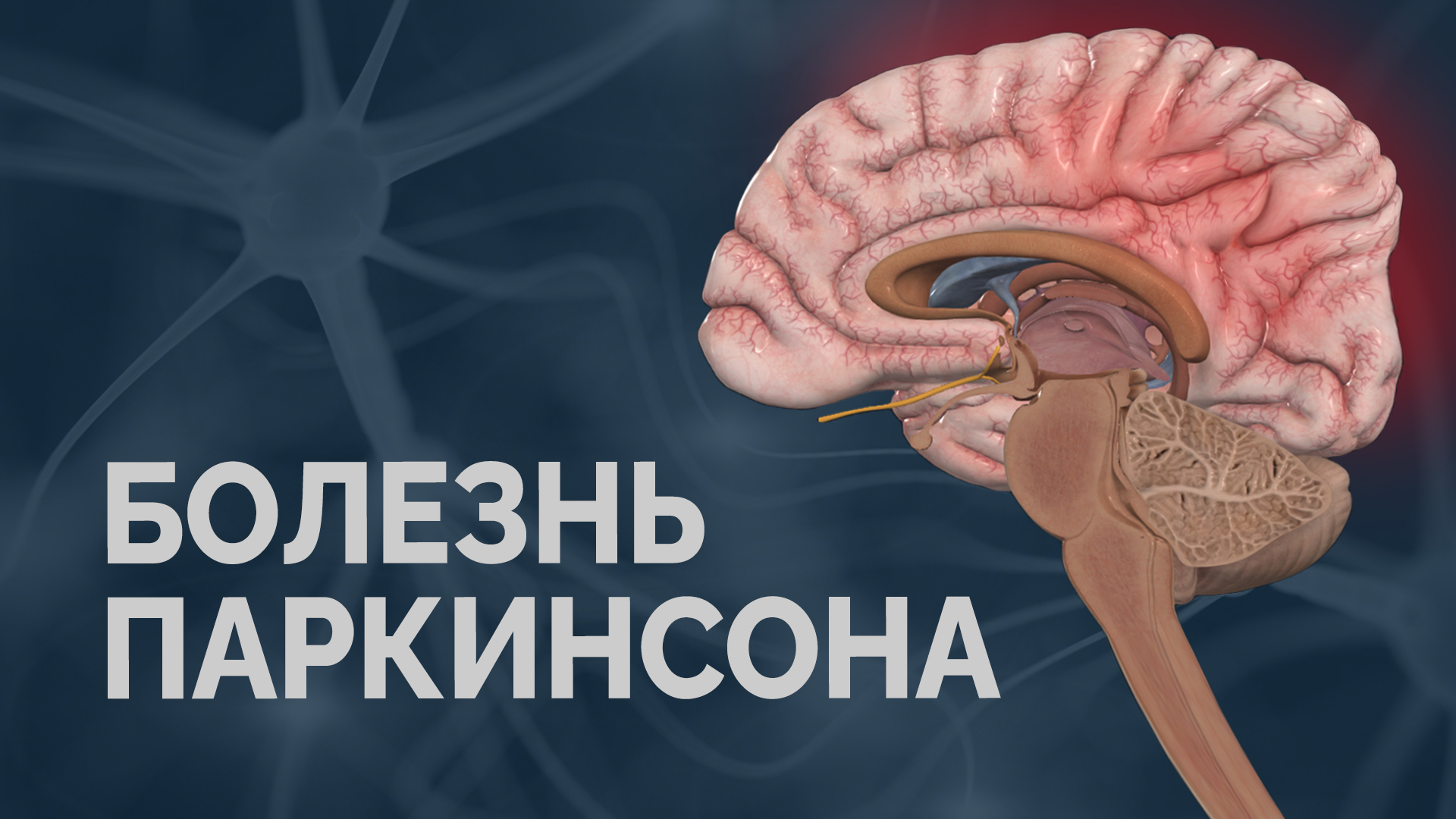 Болезнь Паркинсона. Что это? Как с этим жить? смотреть онлайн