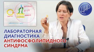 Антифосфолипидный синдром и лабораторная диагностика АФС. Рассказывает Печёрина Е.Ю.