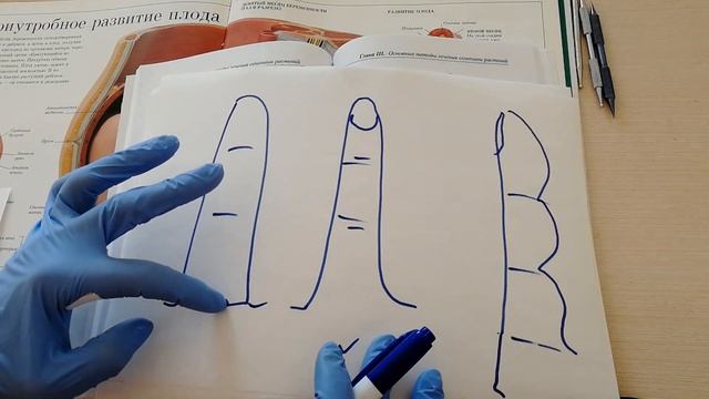 Угроза прерывания беременности на ранних сроках. Самопомощь методом Су Джок.