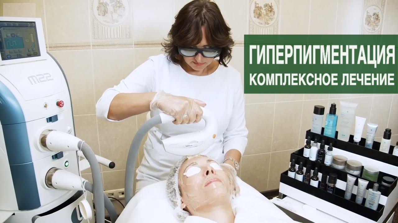 ГИПЕРПИГМЕНТАЦИЯ КОЖИ - комбинированное лечение. IPL-терапия и профессиональные средства. смотреть онлайн