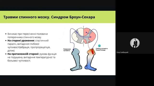 Фізіологія. Рухові функції спинного, довгастого та середнього мозку смотреть онлайн