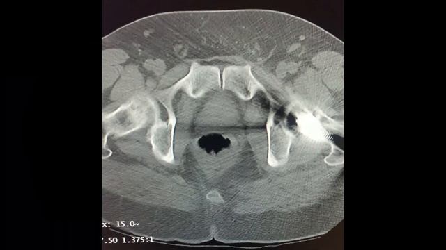 How A CT Scan Works - Principles in Radiology (Computed Tomography) смотреть онлайн