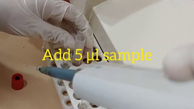 Urea test procedure on semi - auto analyzer смотреть онлайн