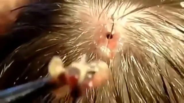 ЛИЧИНКА ОВОДА В ГОЛОВЕ смотреть онлайн